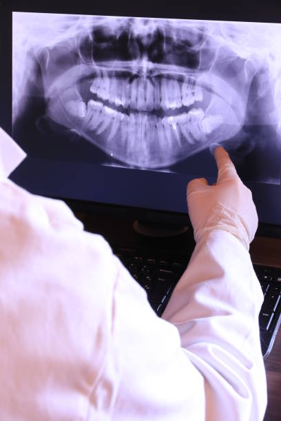 Best Emergency Dental Care for Abscessed Tooth in Lamar, MO