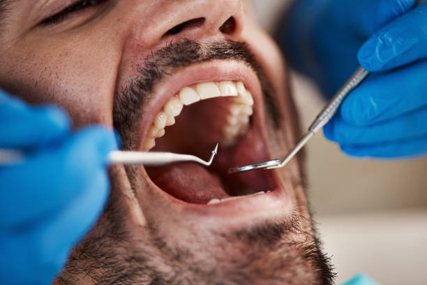 Best Urgent Dental Care for Toothache in Lamar, MO